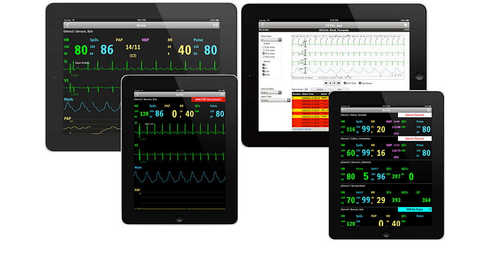 IntelliVue Mobile Caregiver IntelliVue Mobile Caregiver